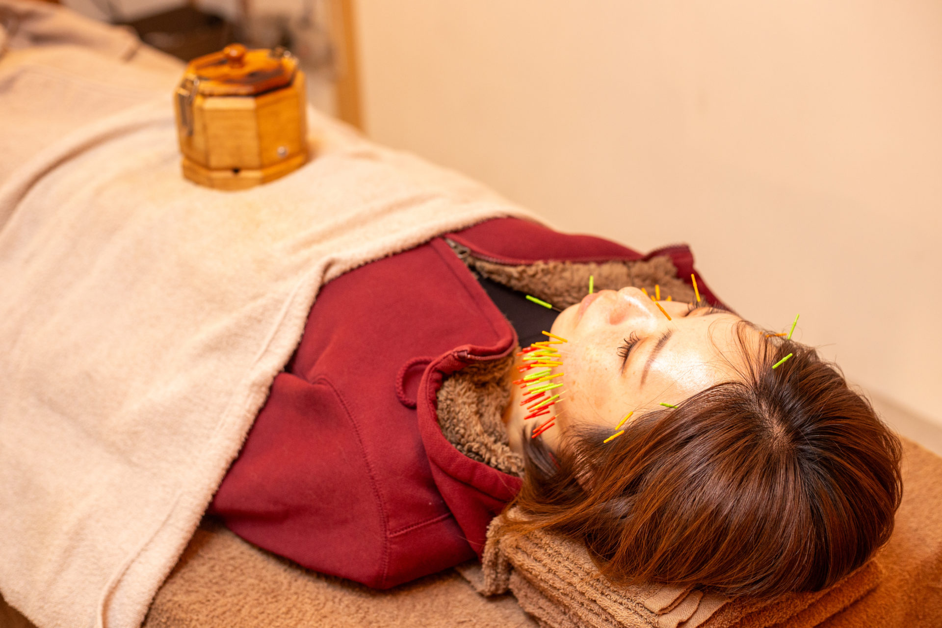 小川ん家の美容鍼灸施術